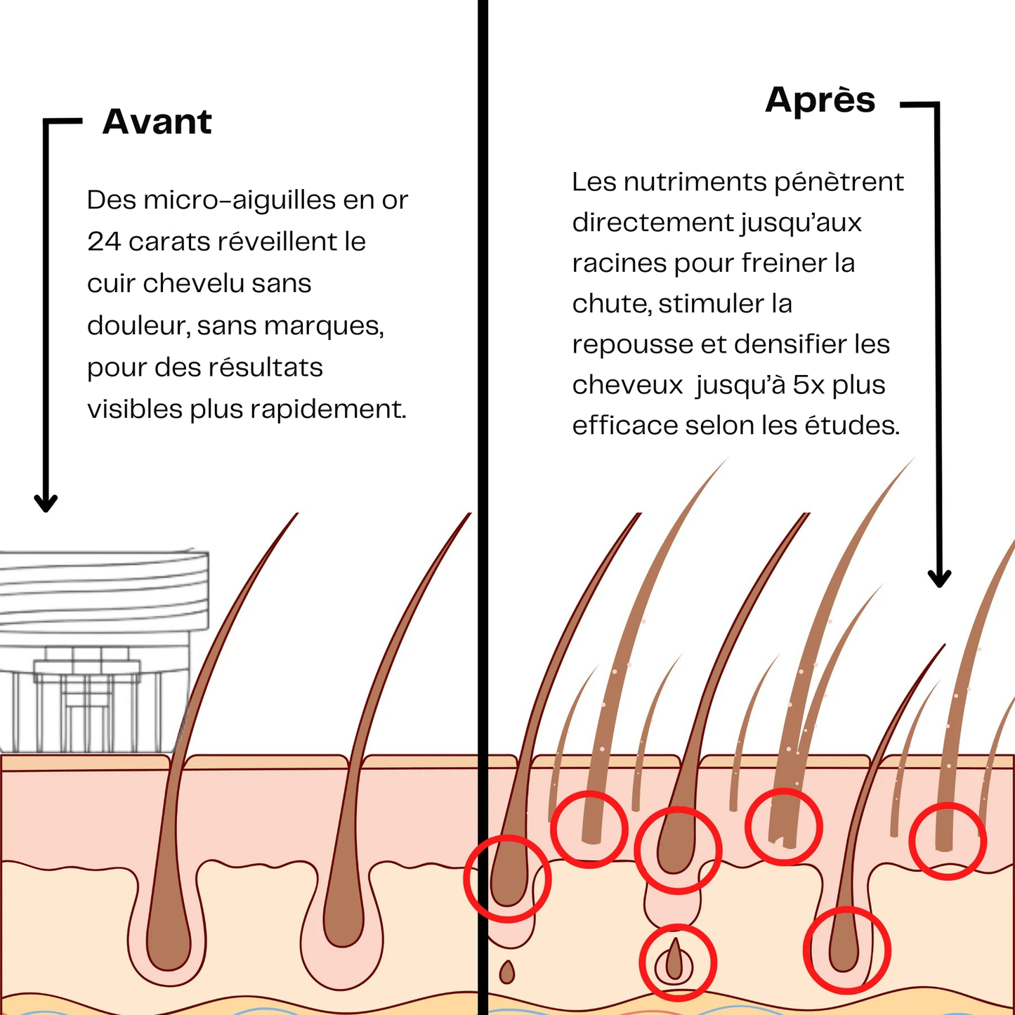 Novavibe infusion pour cheveux