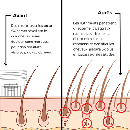Novavibe infusion pour cheveux