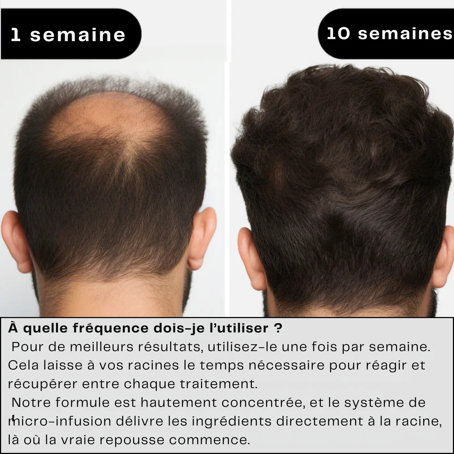 Novavibe infusion pour cheveux
