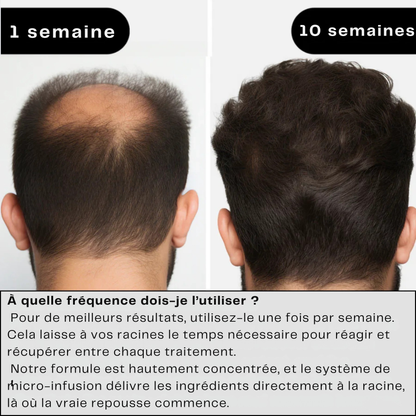 Novavibe infusion pour cheveux