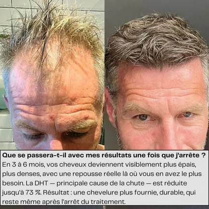 Novavibe infusion pour cheveux